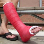 AQUACAST Waterproof Short Leg Cast Cast Kit - OrthoTape.com