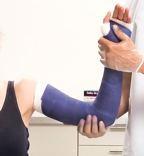 DELTA DRY Waterproof Long Arm Cast Cast Kit - OrthoTape.com