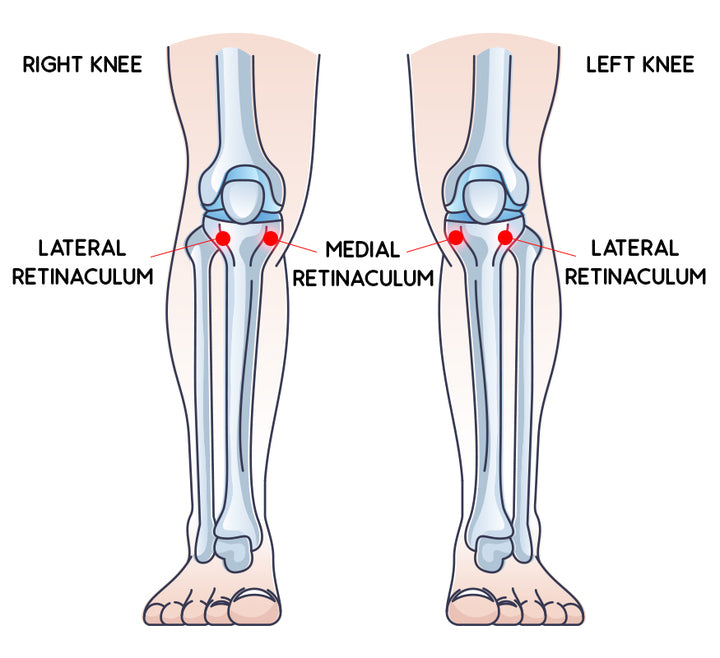 Don Joy OA Reaction Web Hinged Knee Brace - OrthoTape.com
