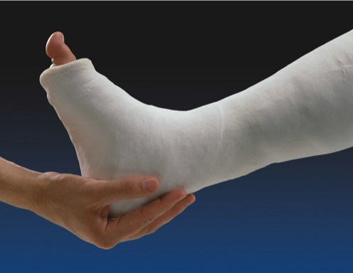 Gypsona S Plaster of Paris Bandages 8 In x 5 Yrd - 12 Rolls - OrthoTape.com