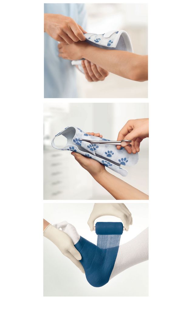 Delta Soft Cast Fiberglass Casting Tape 2 Inch 10 rolls /bx - OrthoTape.com