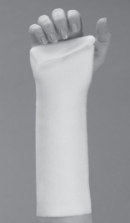Fiberglass Wrist Forearm Splint Kit Volar Splinting  - OrthoTape - OrthoTape.com