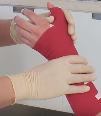 Fiberglass Thumb Spica Splint Kit Thumb Fracture or Sprain- OrthoTape - OrthoTape.com