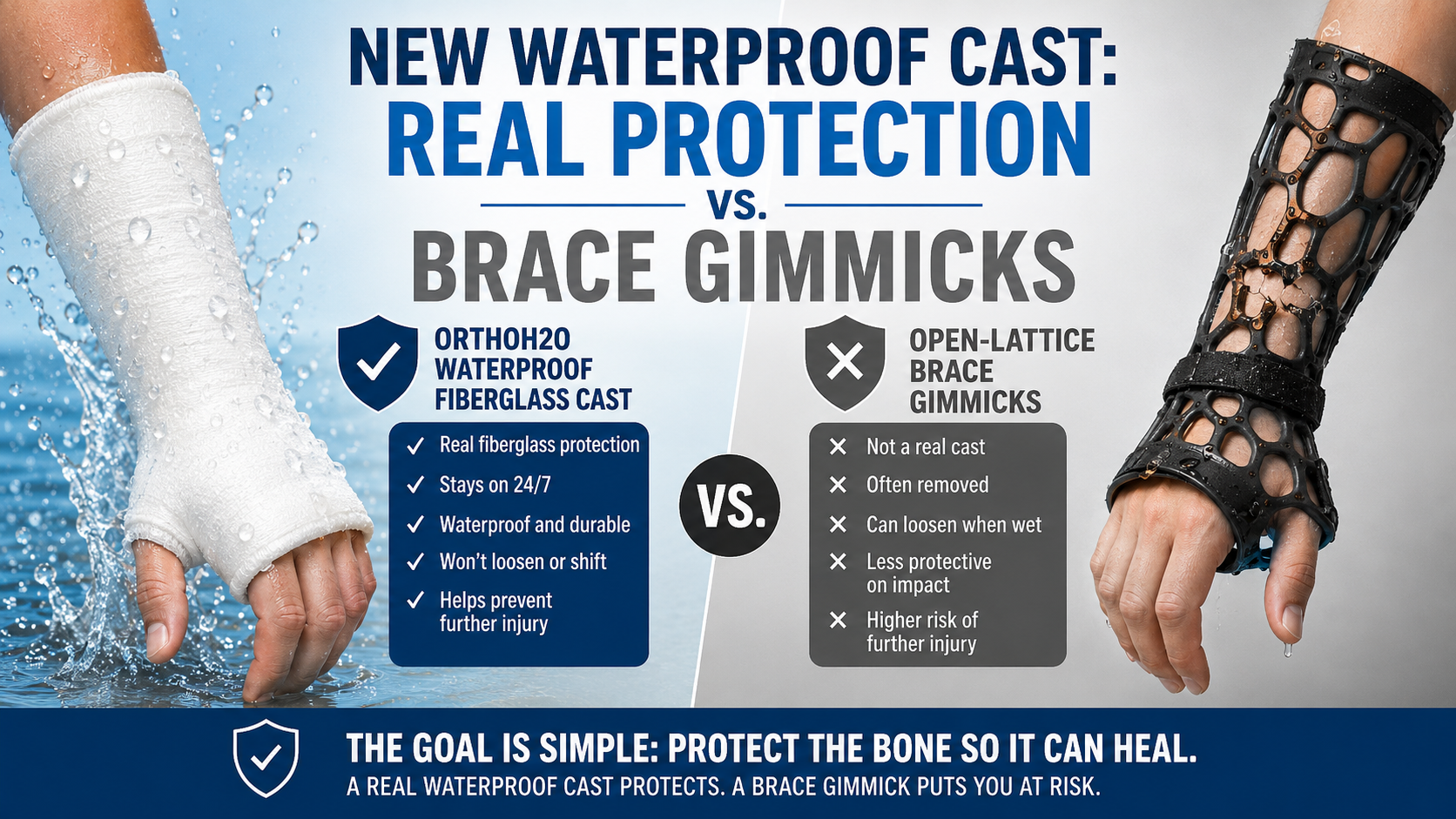 New Waterproof Cast: Real Fiberglass Protection vs Waterproof Brace Gimmicks
