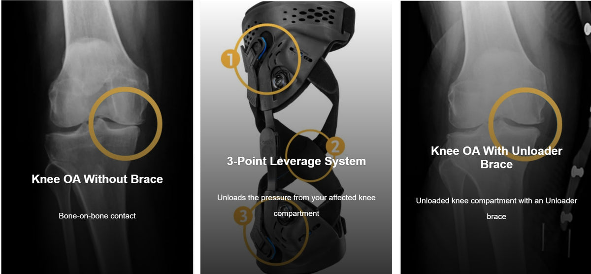Ossur Unloader One X Knee Brace | OA & Bone-on-Bone Pain Relief | OrthoTape