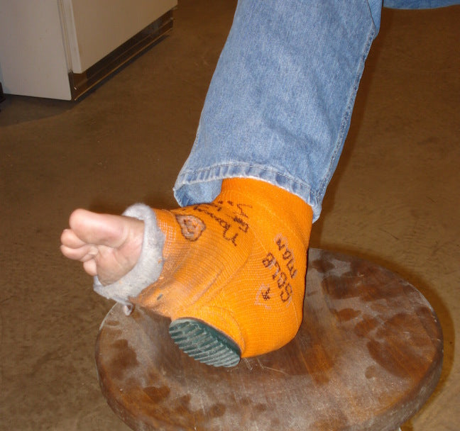 Walking Cast Heel - Leg Cast - OrthoTape