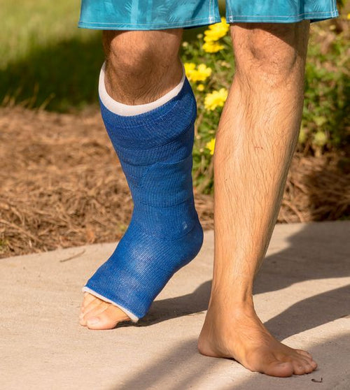 Short Leg Cast Kit | Ankle Cast & Foot Cast | OrthoTape