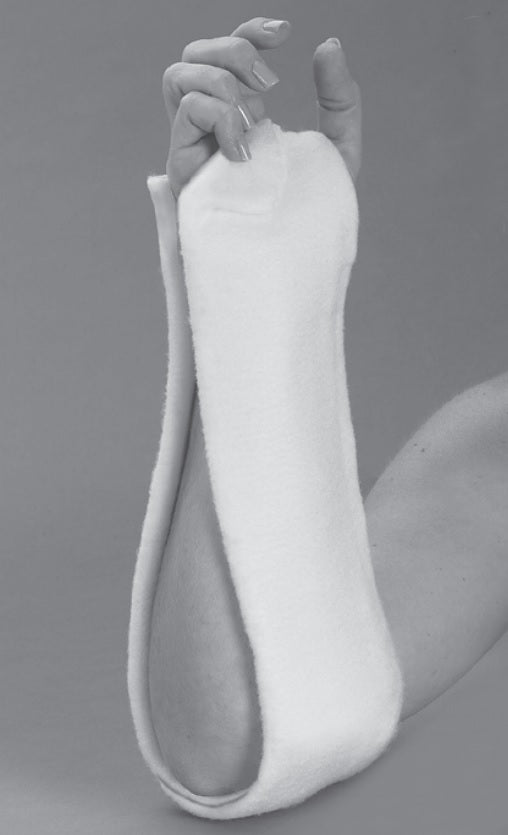 Colles Image Sugar Tong Splint Distal Radius Fracture