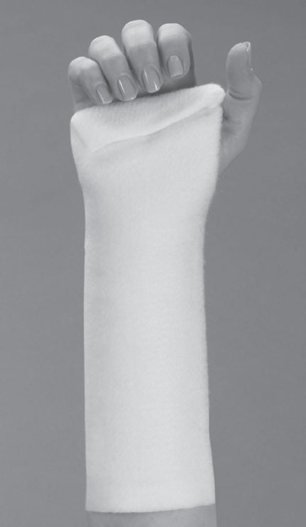 Forearm Volar Cockup Wrist Splint Kit - OrthoTape